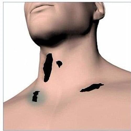 Album cover art for "Sulfuric Acid On My Neck" by Sybyr