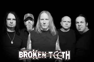 Photo of Broken Teeth