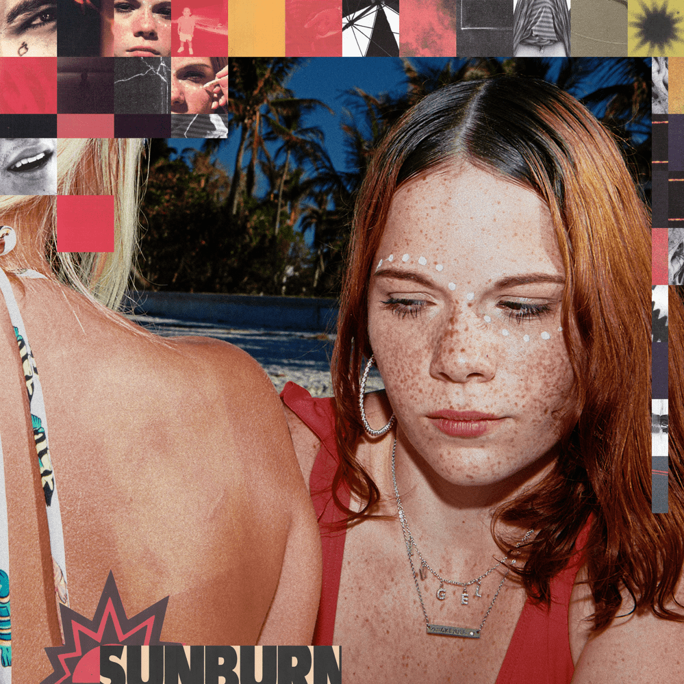 Cover image for Sunburn