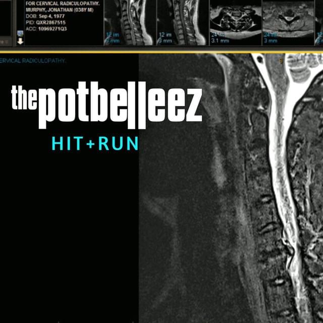 Moulin by The Potbelleez