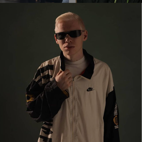 Albino Profile Picture Photo of Albino