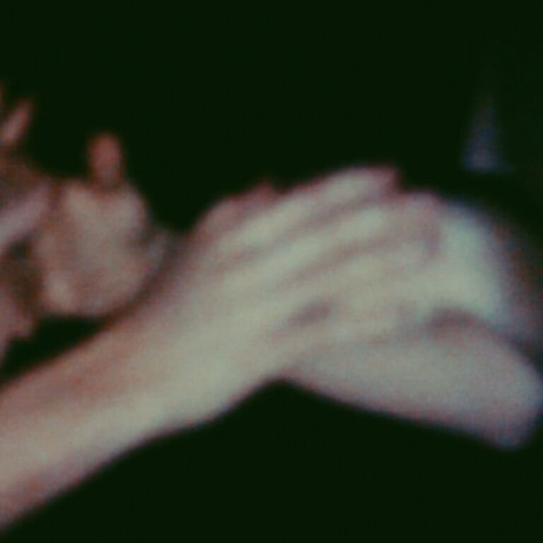 Cover image for It Hurts Until It Doesn’t