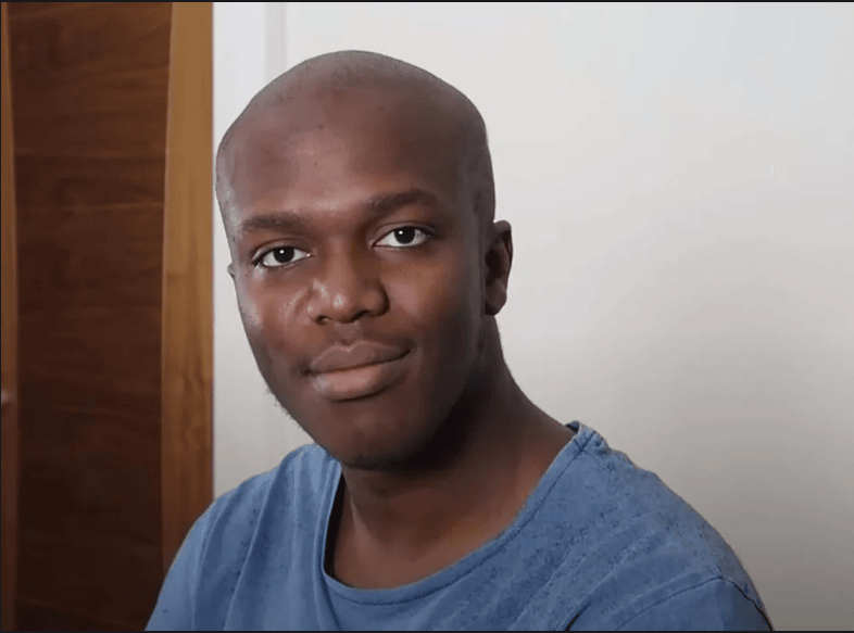 KSI is Bald by ​ticklemytip