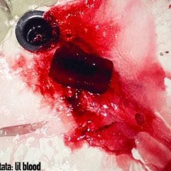 Cover image for lil blood