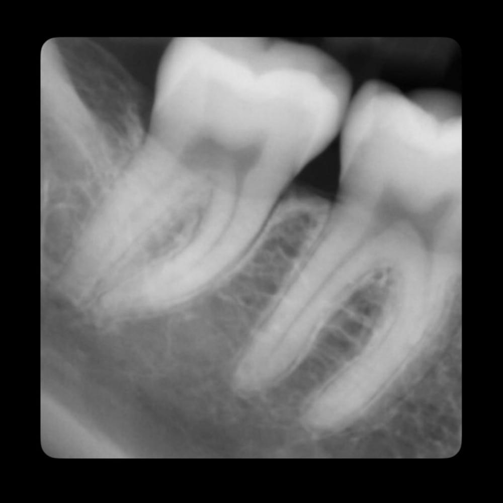 Teeth by Sorry Mom