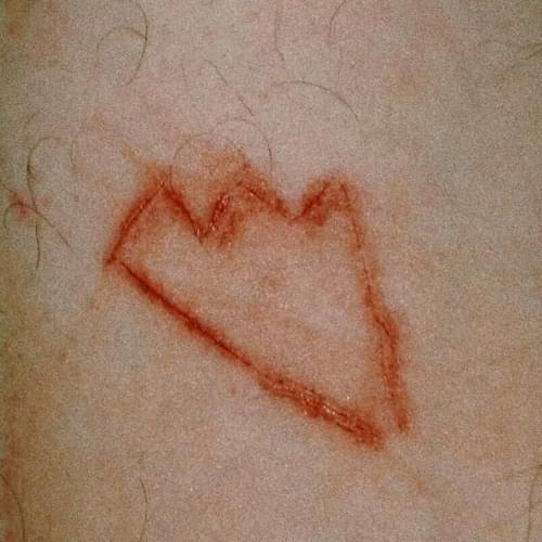 Album cover art for "TUMMY TUCK (XXX "LICK" VERSE)" by XXXTENTACION