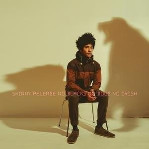 No Blacks, No Dogs, No Irish by Skinny Pelembe