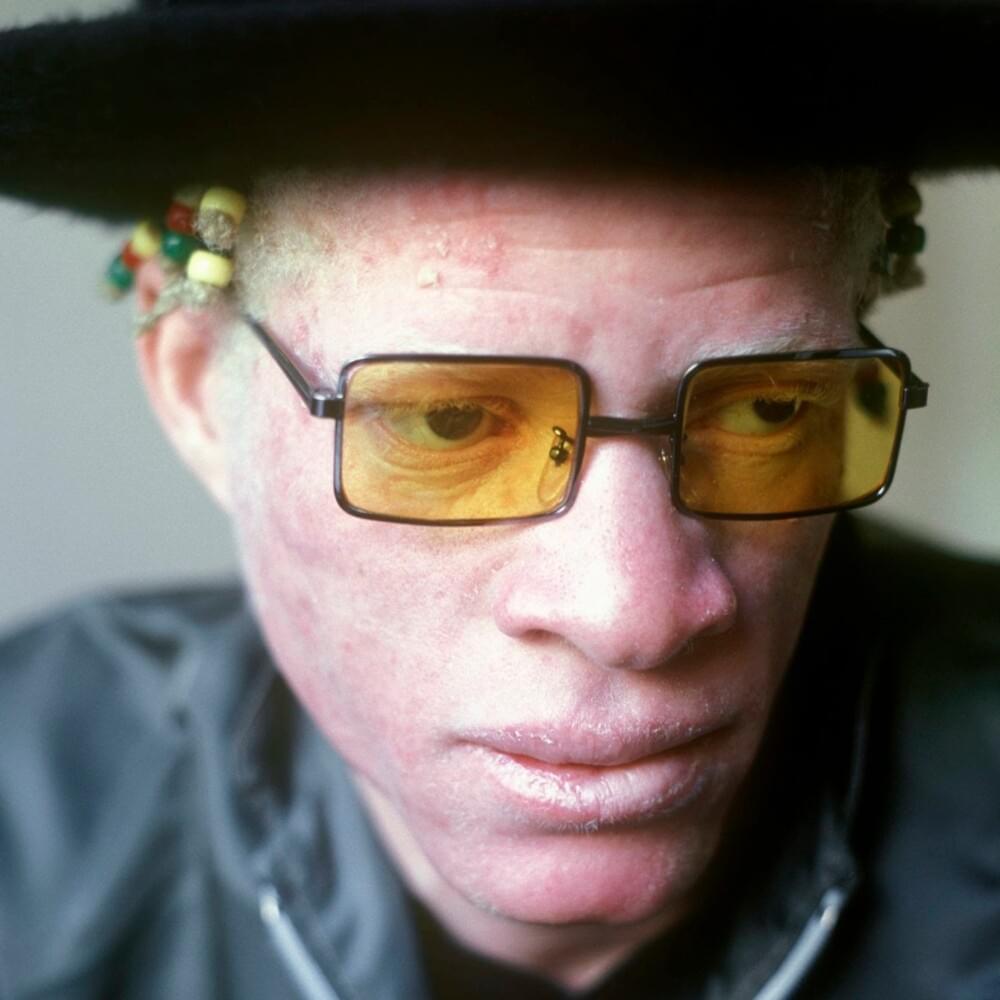 Photo of Yellowman