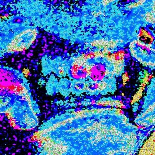 TEETHTEETHTEETH by Self Discovery