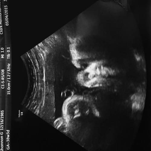 Album cover art for "Lucy Maeve Koenig (38 Weeks In Utero)" by Nmesh