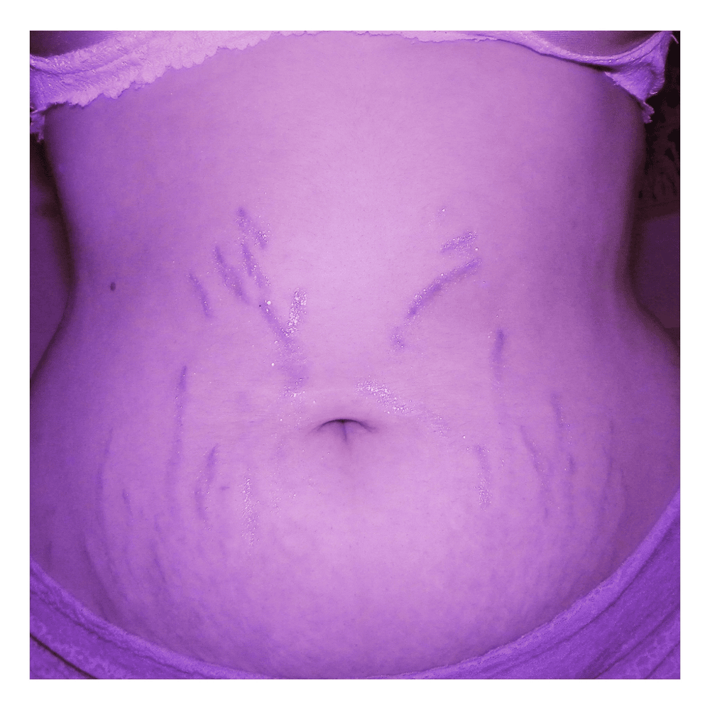 Diet Culture (Stripped) by Brye